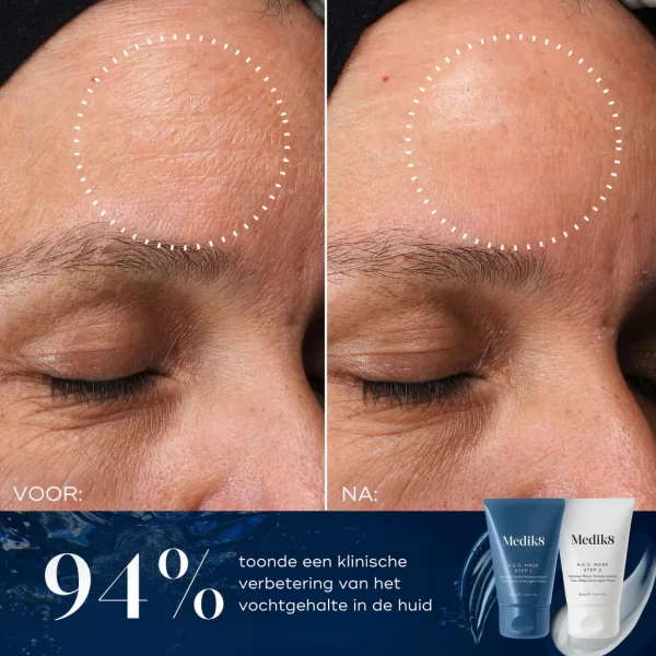 medik8 heo mask
