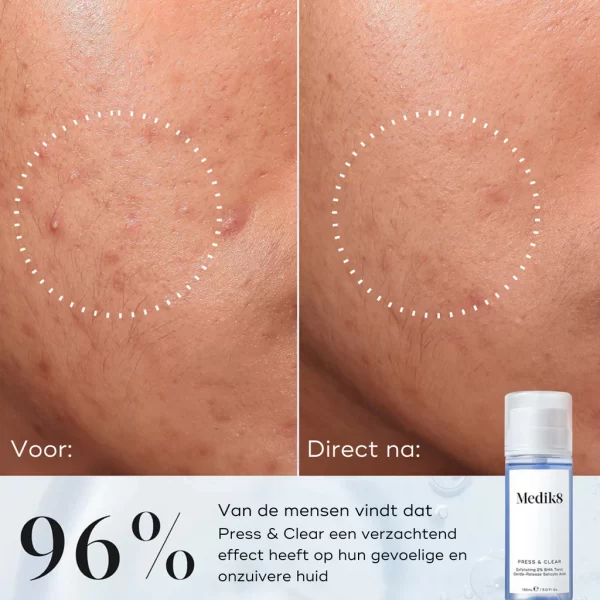 medik8 press & clear cleanser 150 ml